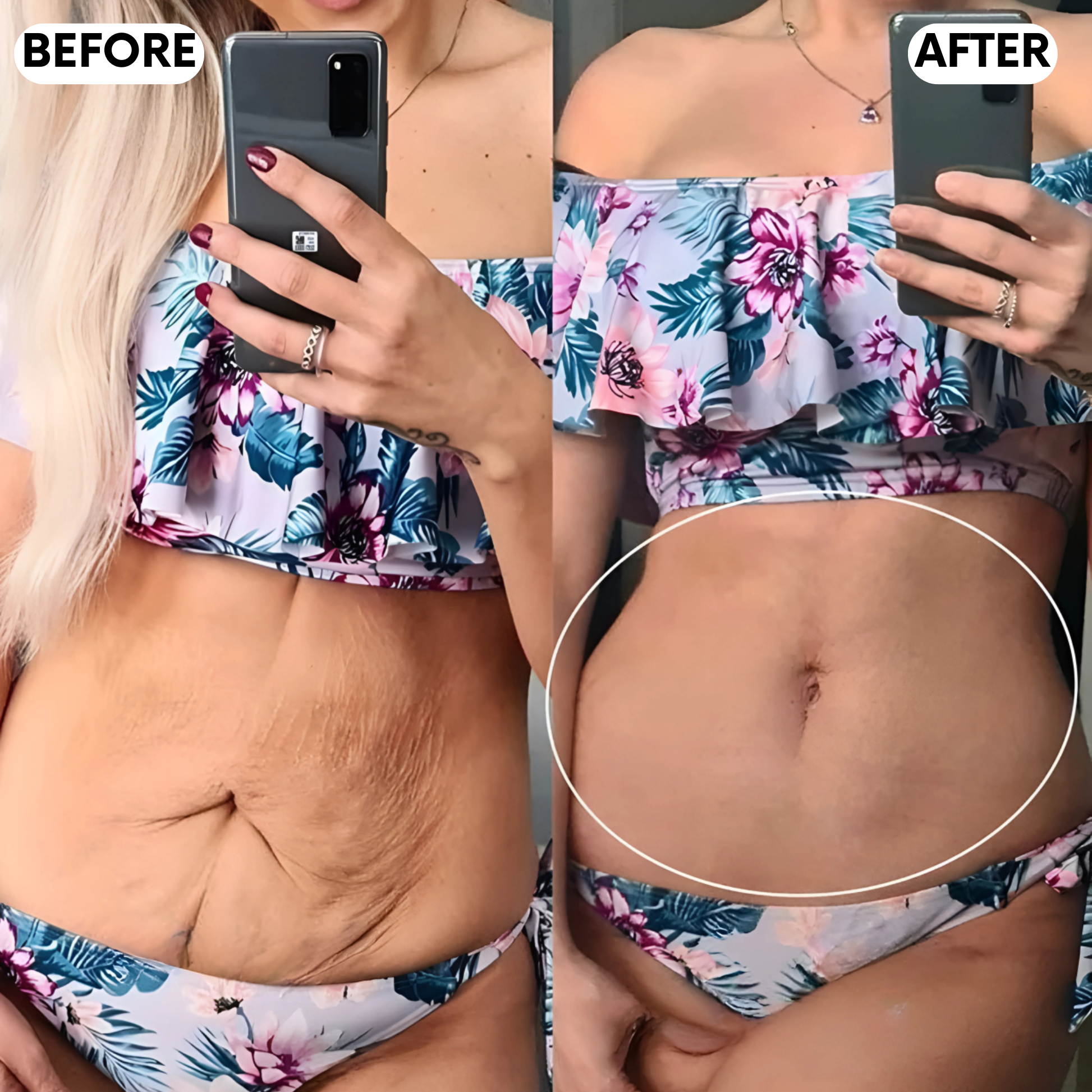 Elanaya® RedeFine Pro