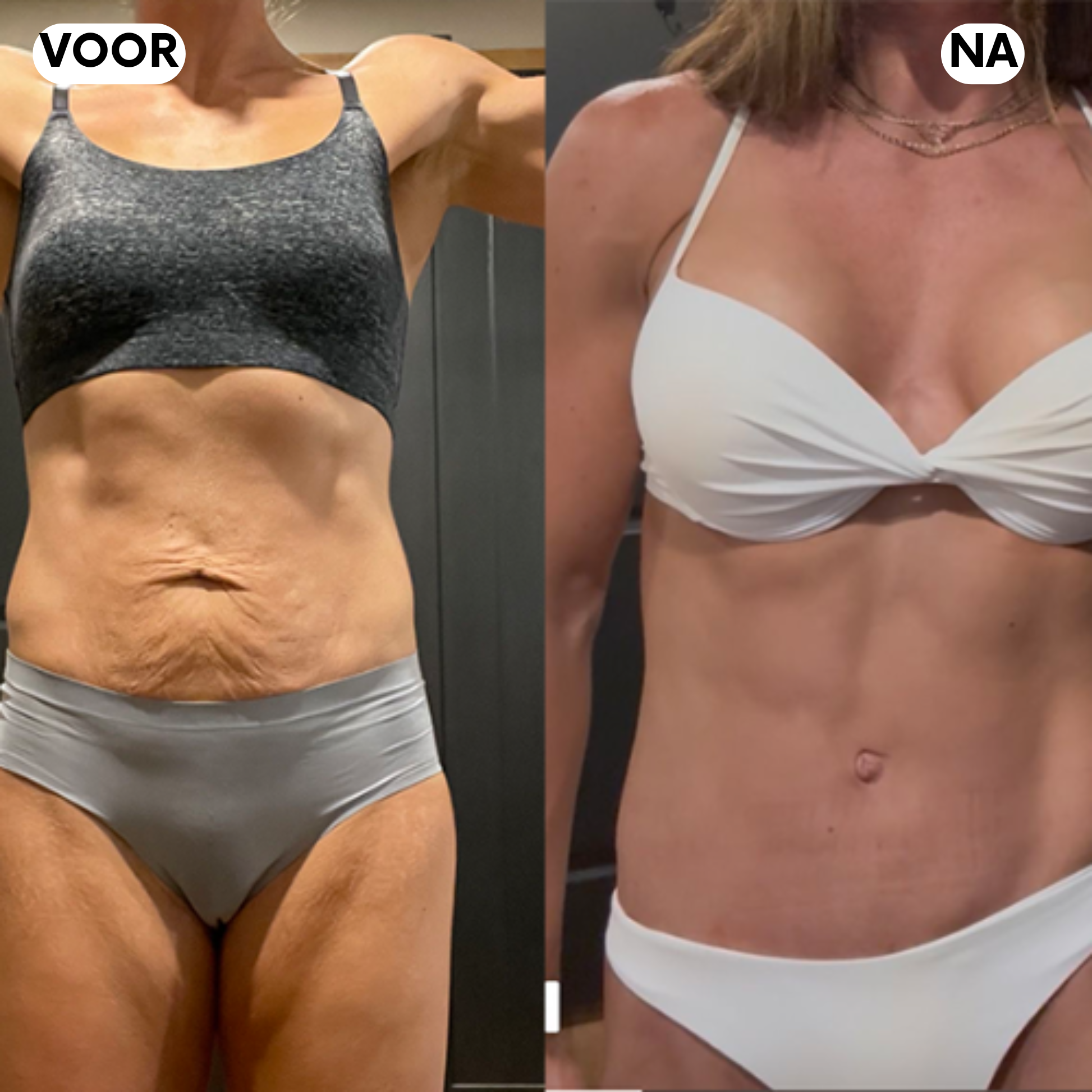 Elanaya® - LumenoLift+