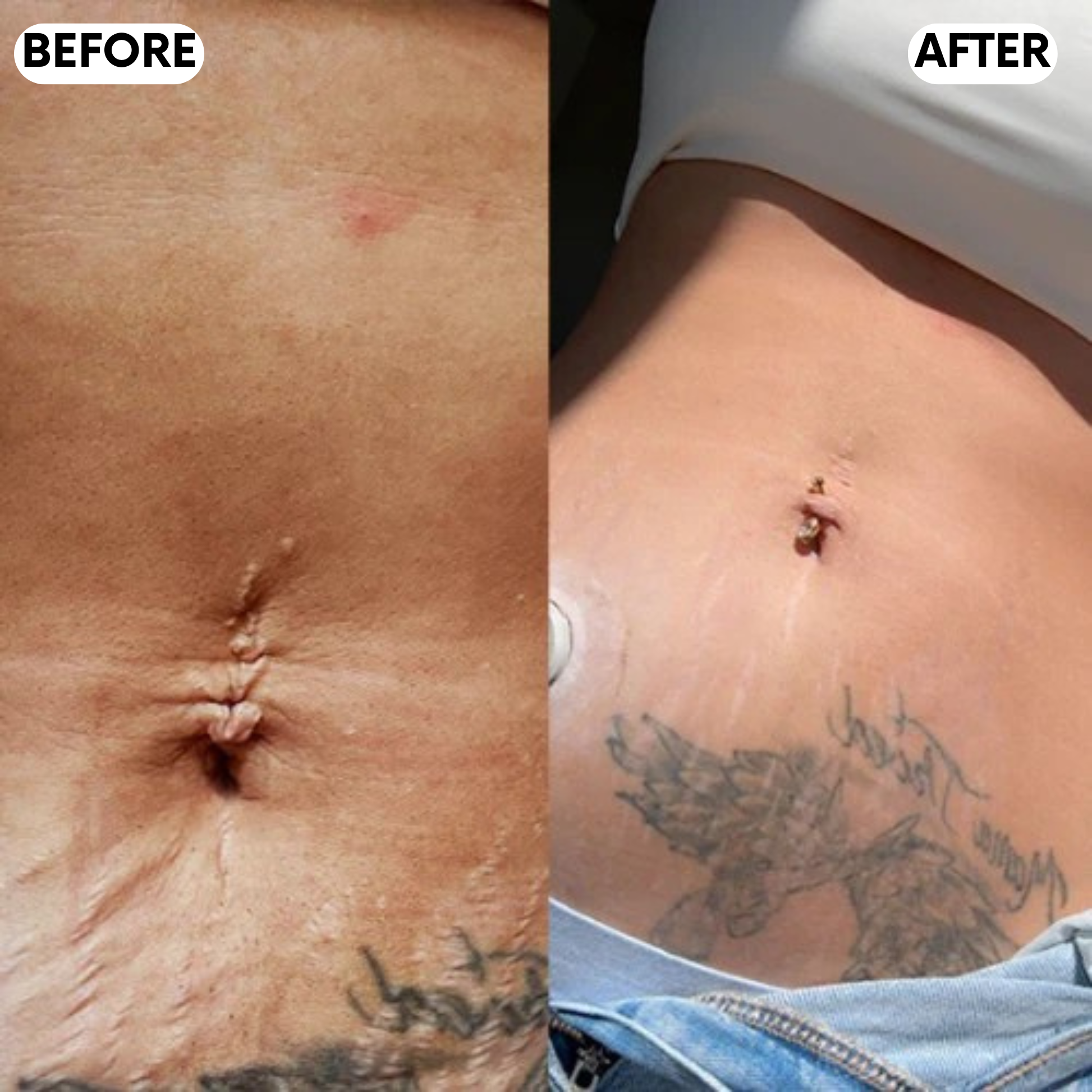 Elanaya® RedeFine Pro